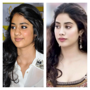Janhvi Kapoor Before and After Surgery